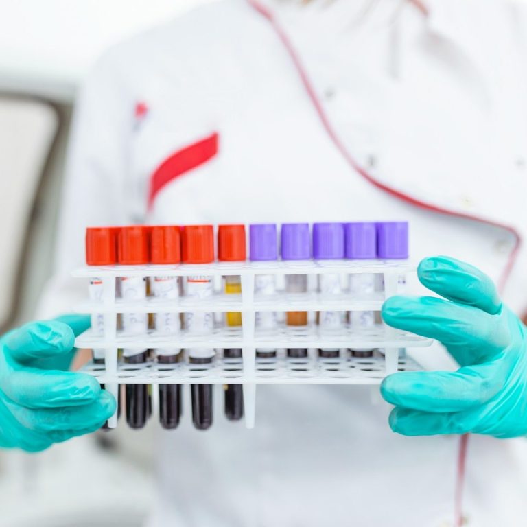 Bluttests Kontrolltermin | TestoCare Männergesundheit & Therapie Blutproben für Labortests zur Kontrolle der Testosterontherapie bei TestoCare